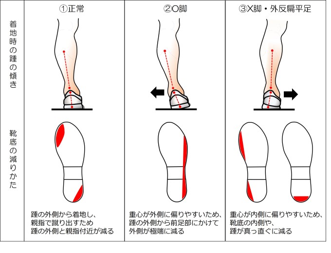 靴底の減りかた